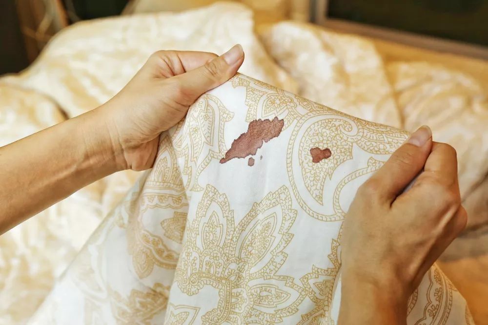 how to get out old blood stains from sheets